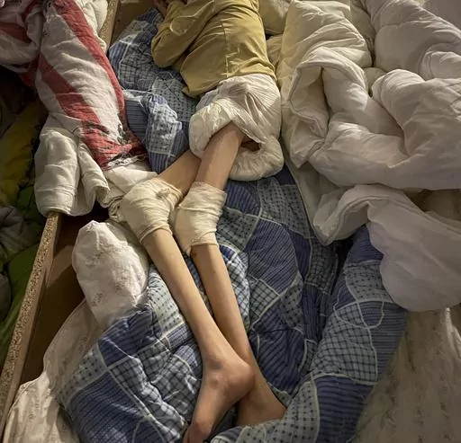 In this image released on July 27, 2023 by the Center of Legal Resources Romania, a malnourished child lies on an improvised bed in the basement of a care home in in the village of Bardesti in the central Romanian Mures County. The Centre for Legal Resources, or CLR, which conducted an unannounced inspection of the home, found alarming levels of neglect and abuse, saying that, on top of 23 residents inside the main building, seven more were found living in appalling conditions in a dingy basemen