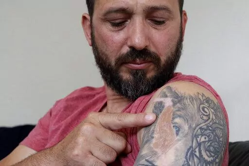 Al Noor mosque shooting survivor Temel Atacocugu points to the scar of a bullet wound in his arm during an interview at his home, Feb. 25, 2020, in Christchurch, New Zealand. Survivors from the mass shooting at two Christchurch mosques describe their reactions to the Buffalo supermarket shooting. The Buffalo gunman was apparently inspired by the Christchurch shooter after watching a copy of his livestream video. (AP Photo/Mark Baker, File)